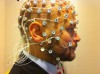 EEG elektródák