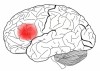 A Broca-terület – Nem csak ezt használjuk!