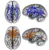 A féltekéken belüli kapcsolatok kéken, a féltekék közötti kapcsolatok narancssárgán látszanak. A felső sorban a férfi, az alsóban a női agy képe látható.