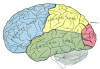 Az agy főbb területei: a zöld a temporális lebeny, a sárga a parietális lebeny