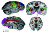 Az agy területeiről készült fMRI képek