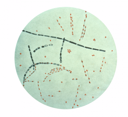 Bacillus anthracis