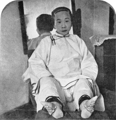 Elkötött lábfejű kínai nő 1911-ből