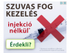 Fogas helyesírási problémák