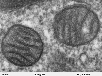 Két mitokondrium elektronmikroszkópos képe