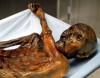 Ötzi